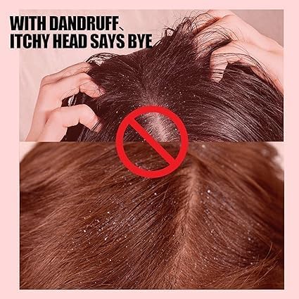 Sulfur8 Medicated Anti-Dandruff Conditioner for Braids, 356 ml