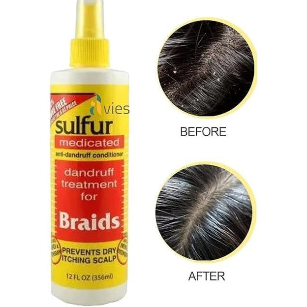 Sulfur8 Medicated Anti-Dandruff Conditioner for Braids, 356 ml